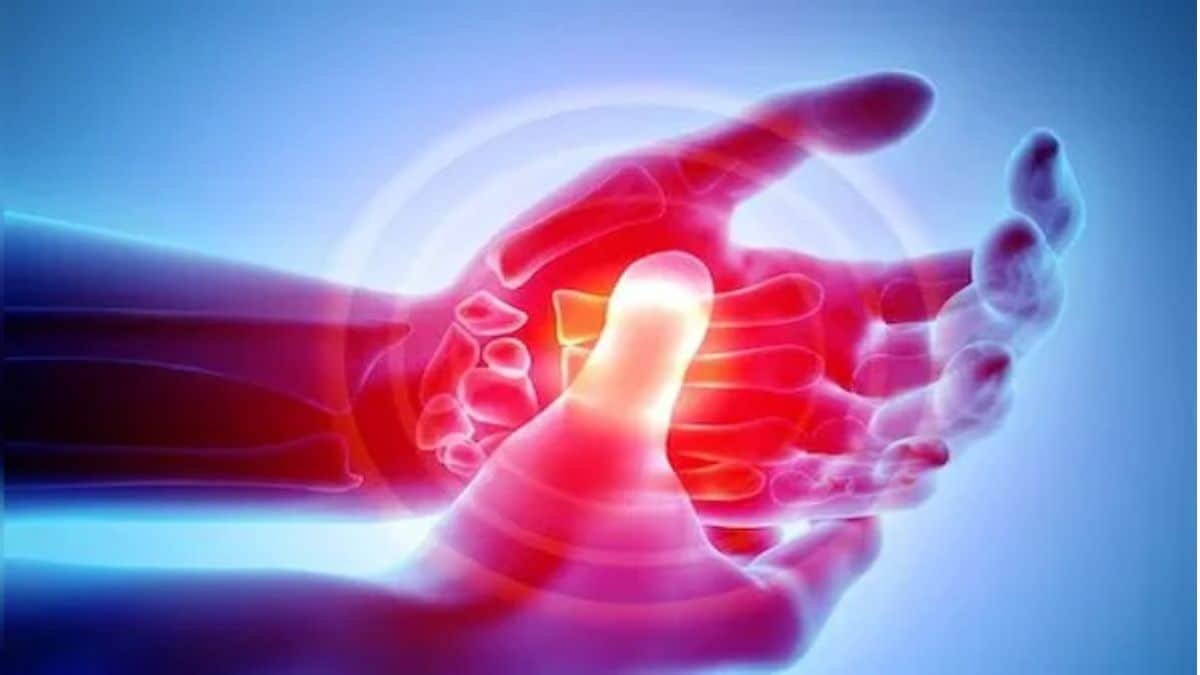 Experts call arthritis a silent epidemic urge early diagnosis to