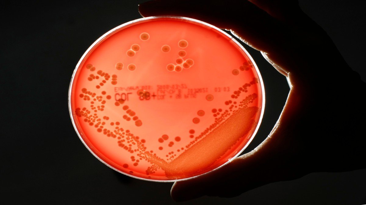 How superbugs could kill nearly 40 million people by 2050 – Firstpost