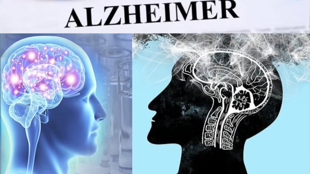 The alarming rise in Alzheimer’s cases and its impact on global health – Firstpost