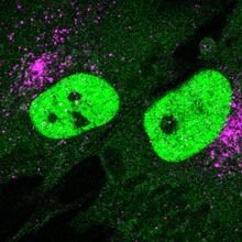 A STING Operation in Safeguarding Cells from Stress TS